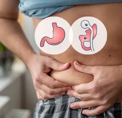 Roux-En-Y Gastric Bypass