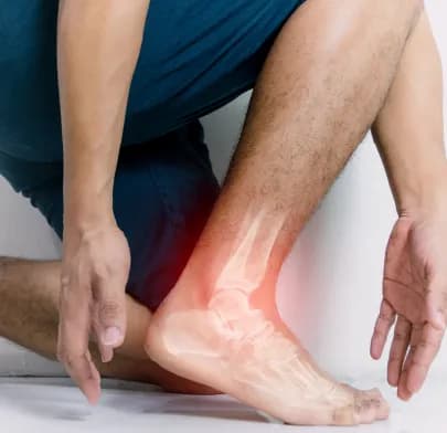 Person holding painful ankle with skeletal overlay, illustrating condition related to Foot and Ankle Surgery in India.