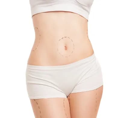 Midsection marked for body contouring, linked to Gastric Bypass Surgery.