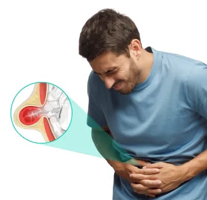 Hernia Surgery