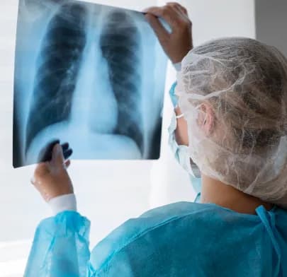 Medical professional examining a chest X-ray to assess signs of Lung Cancer in the lungs and ribcage.