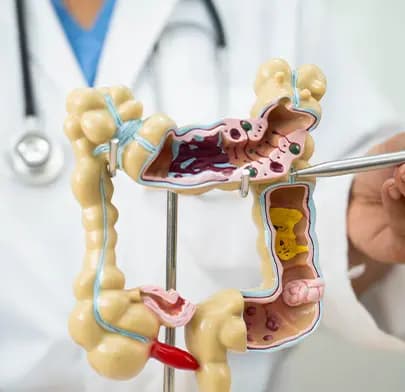 Sigmoidoscopy