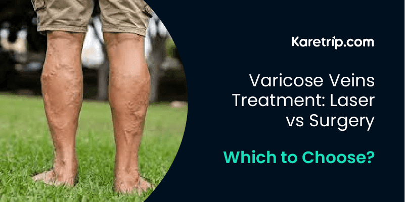 Varicose Veins Treatment: Laser vs Surgery – Which to Choose?