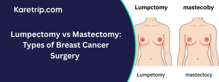 Lumpectomy vs Mastectomy: Types of Breast Cancer Surgery Explained